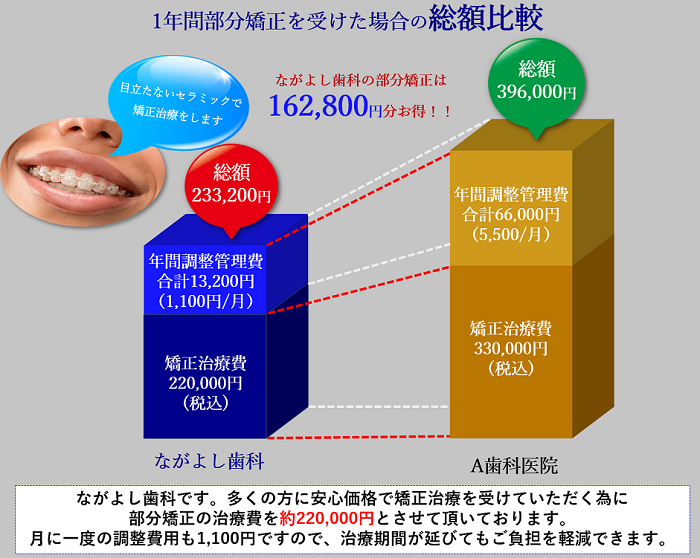 セラミックブラケットでの部分矯正