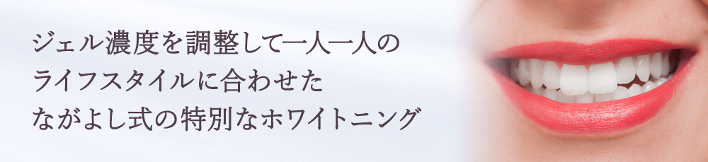 一人一人のライフスタイルに合わせた ホワイトニング|豊中のホワイトニングはながよしデンタルクリニック
